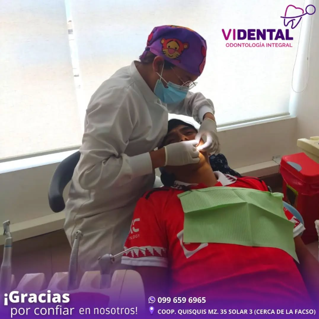 Imagen de Sellantes Dentales